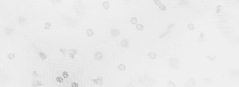 Протоколпо акне